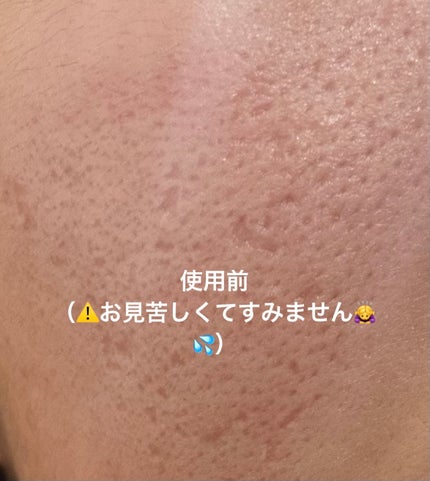 S100 リードル/VT/美容液を使ったクチコミ(3枚目)