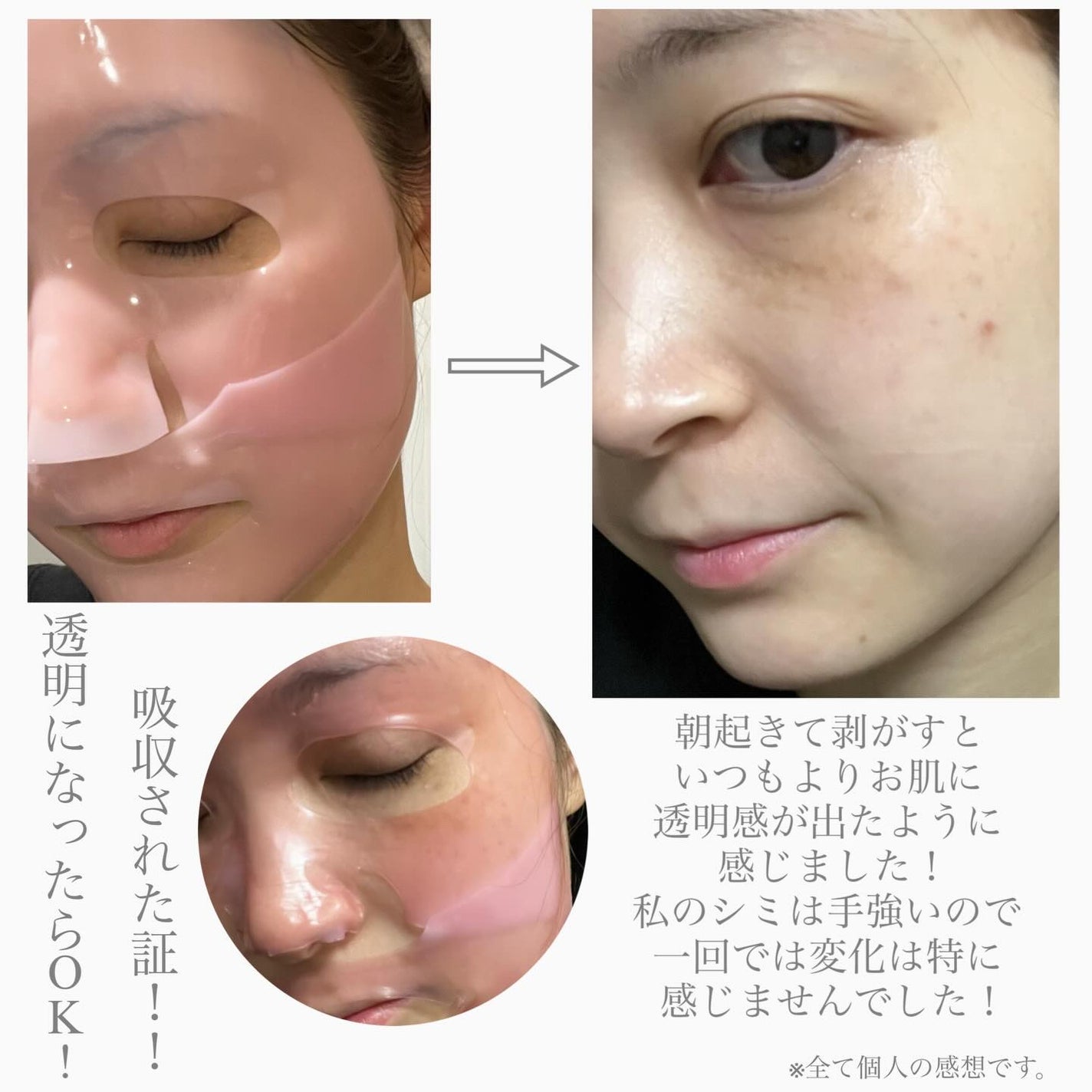 TXAナイアシンアミド ブライトニングマスク/from medi+/シートマスク・パックを使ったクチコミ(3枚目)