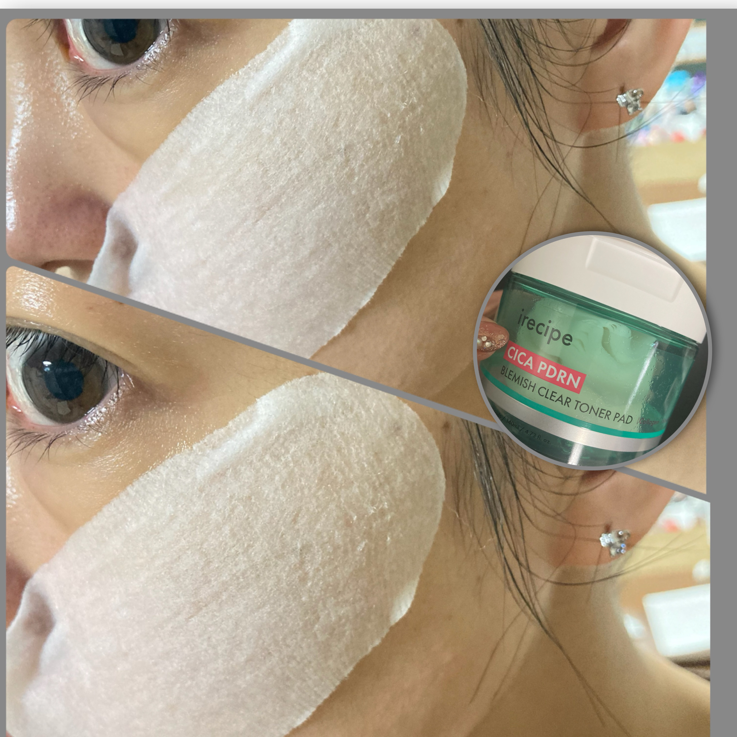 シカ PDRN 跡 クリアー トナーパッド/irecipe/トナーパッドを使ったクチコミ（2枚目）