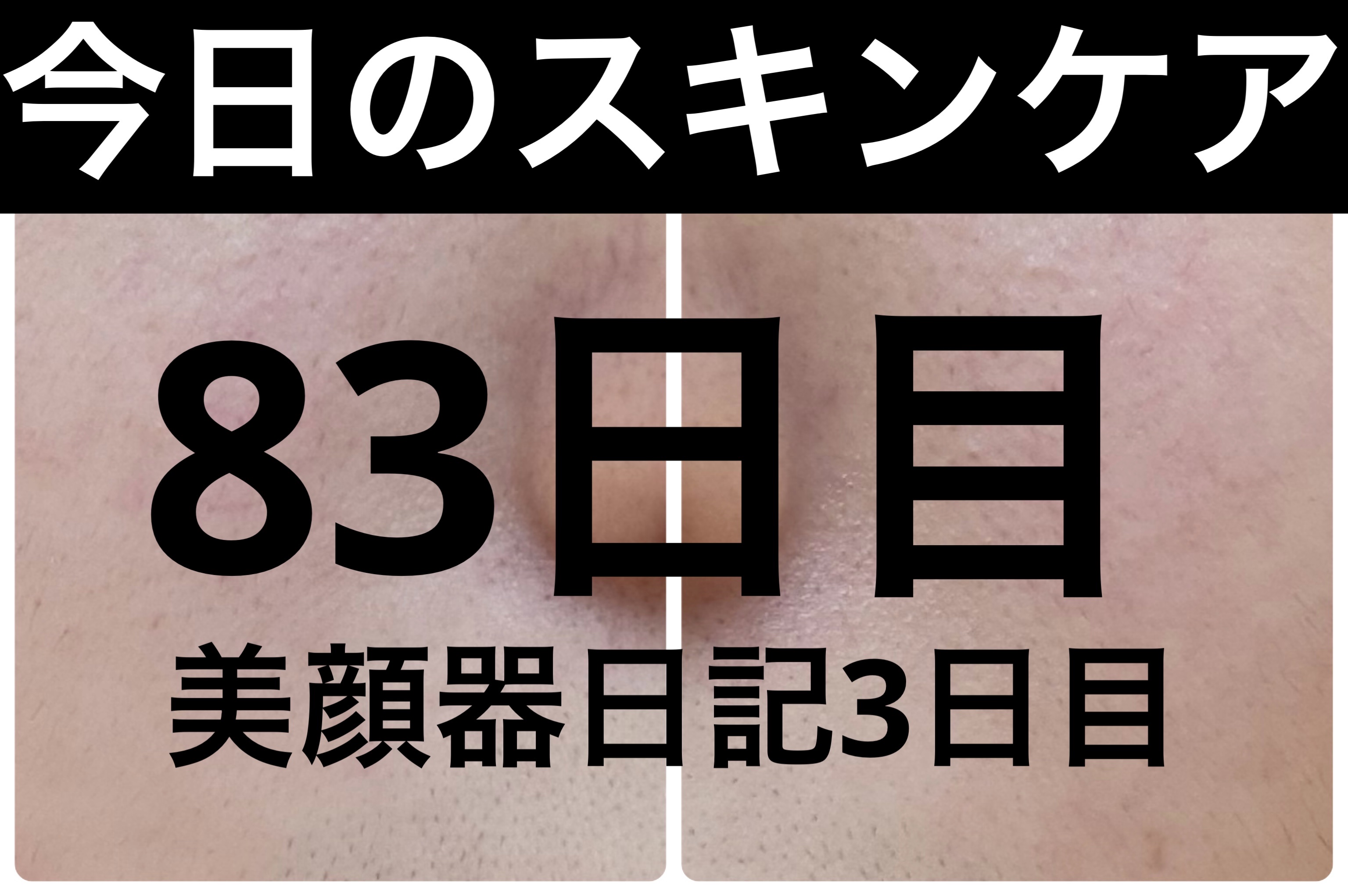 モーニングジェルウォッシュ/ビトレスキン/その他洗顔料を使ったクチコミ（1枚目）