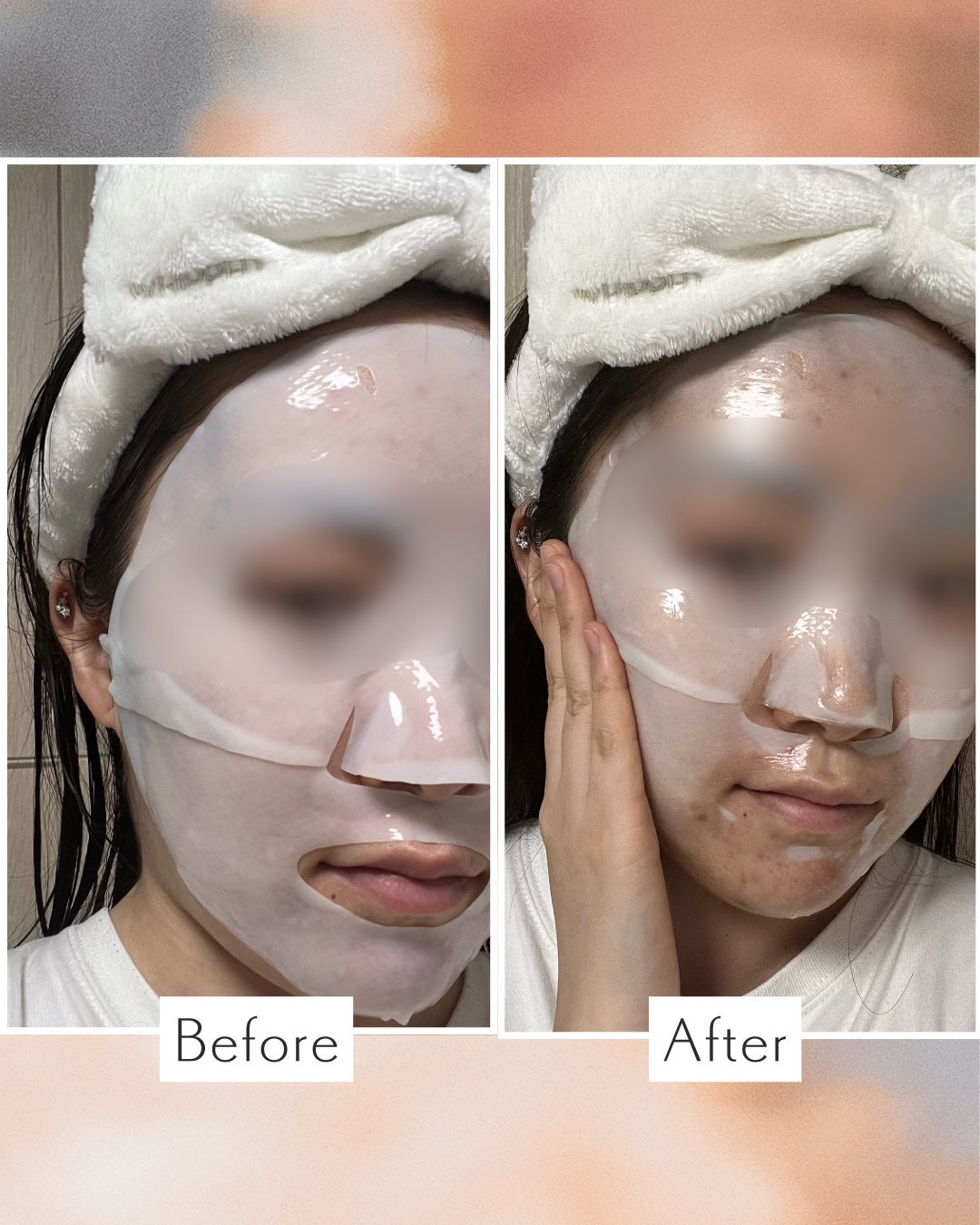 パーフェクト リアル パフォーマンス シカコラーゲンマスクパック /ダーマフィックス/シートマスク・パックを使ったクチコミ(2枚目)