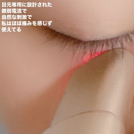 MEラボンアイ/ME/美顔器・マッサージを使ったクチコミ(5枚目)