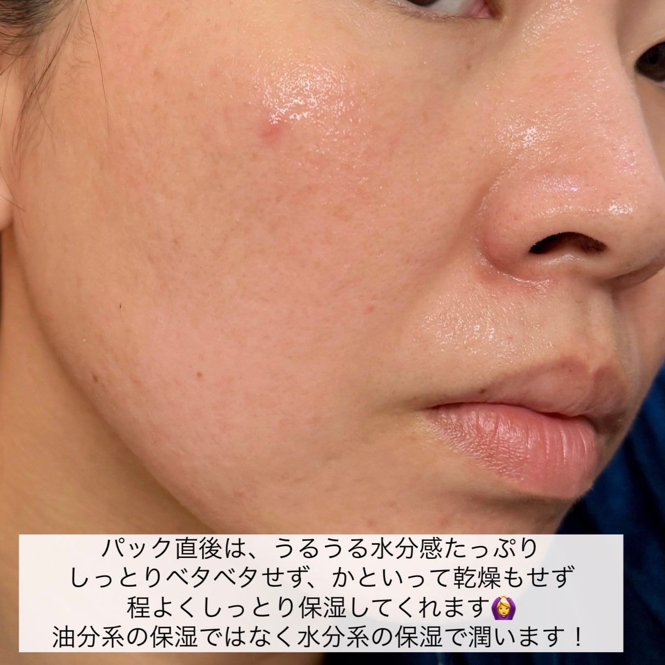 ドクダミ77 % 鎮静マスクパック/Anua/シートマスク・パックを使ったクチコミ(6枚目)