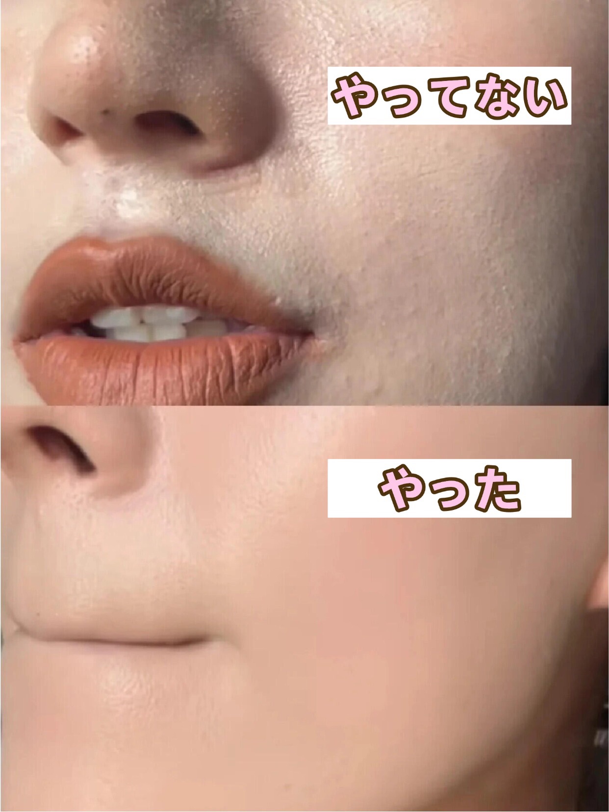 アネトス バランシング トリートメントクリーム/Anetos/フェイスクリームを使ったクチコミ（1枚目）