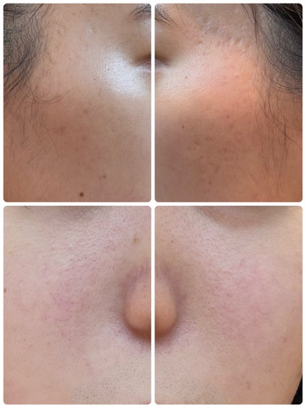 モーニングジェルウォッシュ/ビトレスキン/その他洗顔料を使ったクチコミ(2枚目)