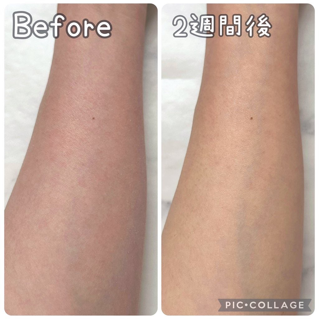 ナイアシンアミド 5% ボディローション/b.clinicx/ボディローションを使ったクチコミ(3枚目)