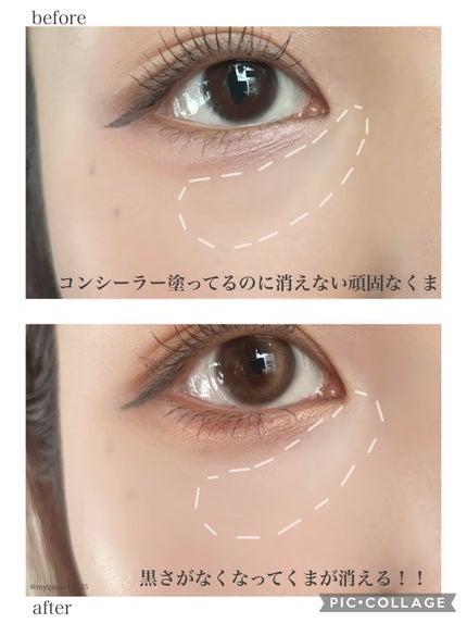 クマメンテパウダー/muice/パウダーコンシーラーを使ったクチコミ(3枚目)