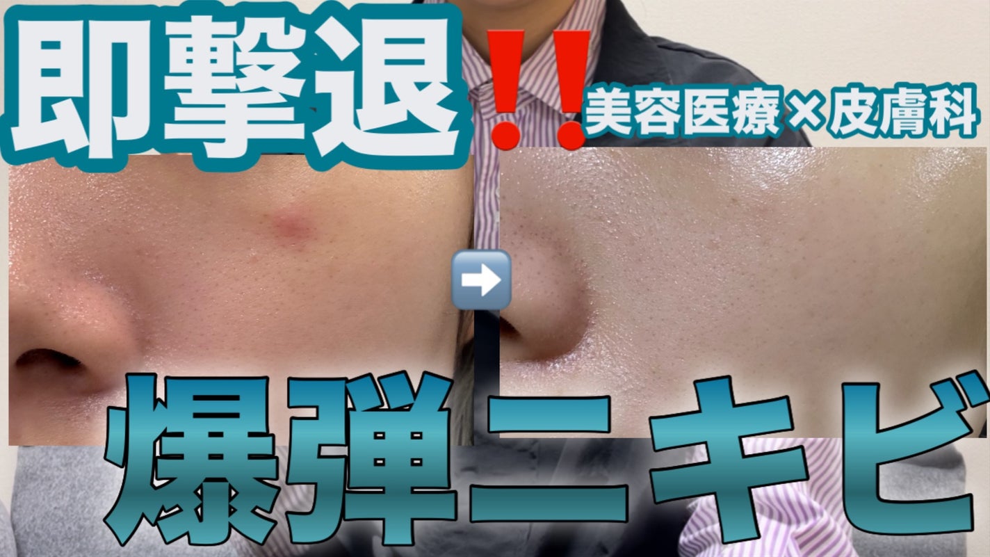 ãã¡ãð°ã¹ãã³ã±ã¢ããã on LIPS ãYouTubeæŽæ°ããŠãŸãâ©.*Ë#ããã#ãããã±ã¢#ããã..ãïŒ1æç®ïŒ