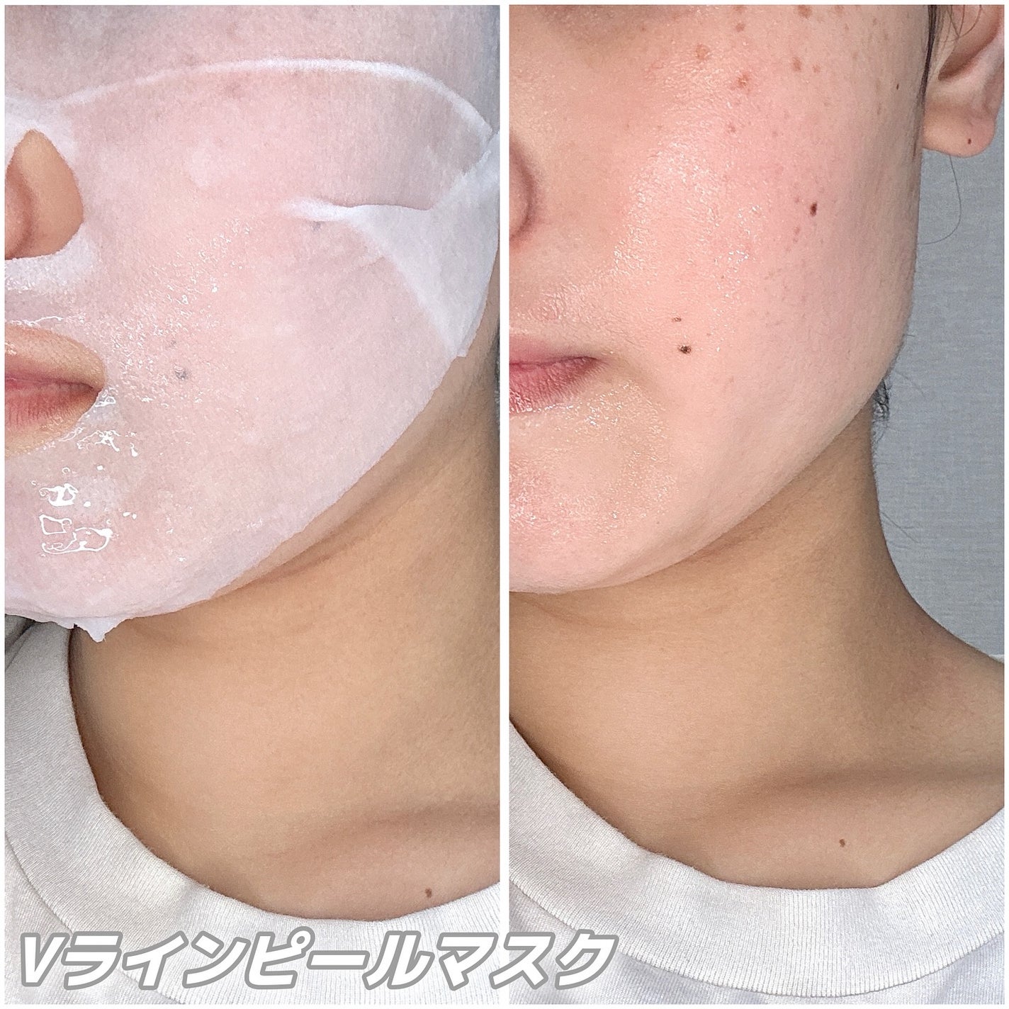 WATER PEEL MASK/VT/シートマスク・パックを使ったクチコミ(5枚目)