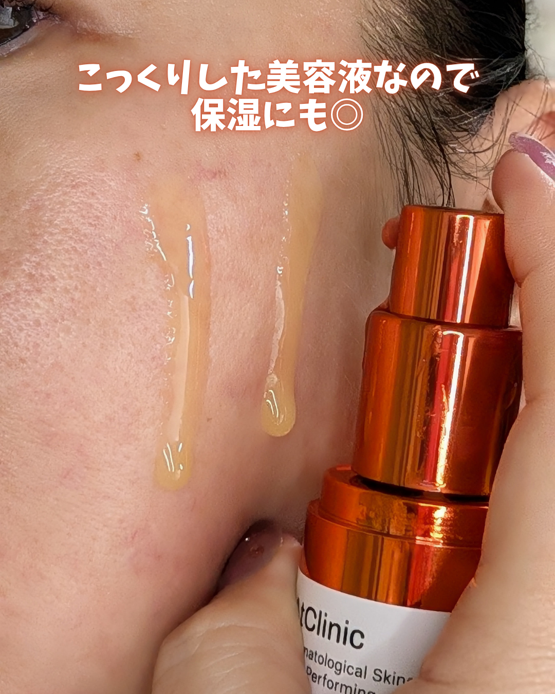 アットクリニックリンクルショットアンプル/DOMINAS/美容液を使ったクチコミ(3枚目)