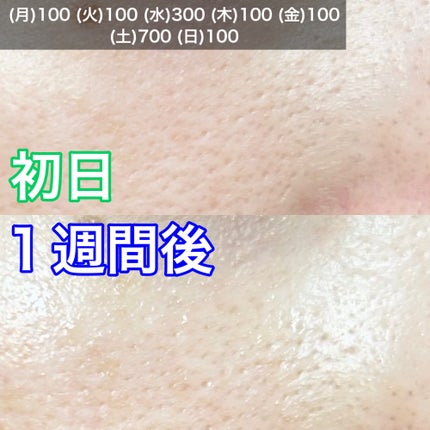 リードルショット100/VT/美容液を使ったクチコミ(4枚目)