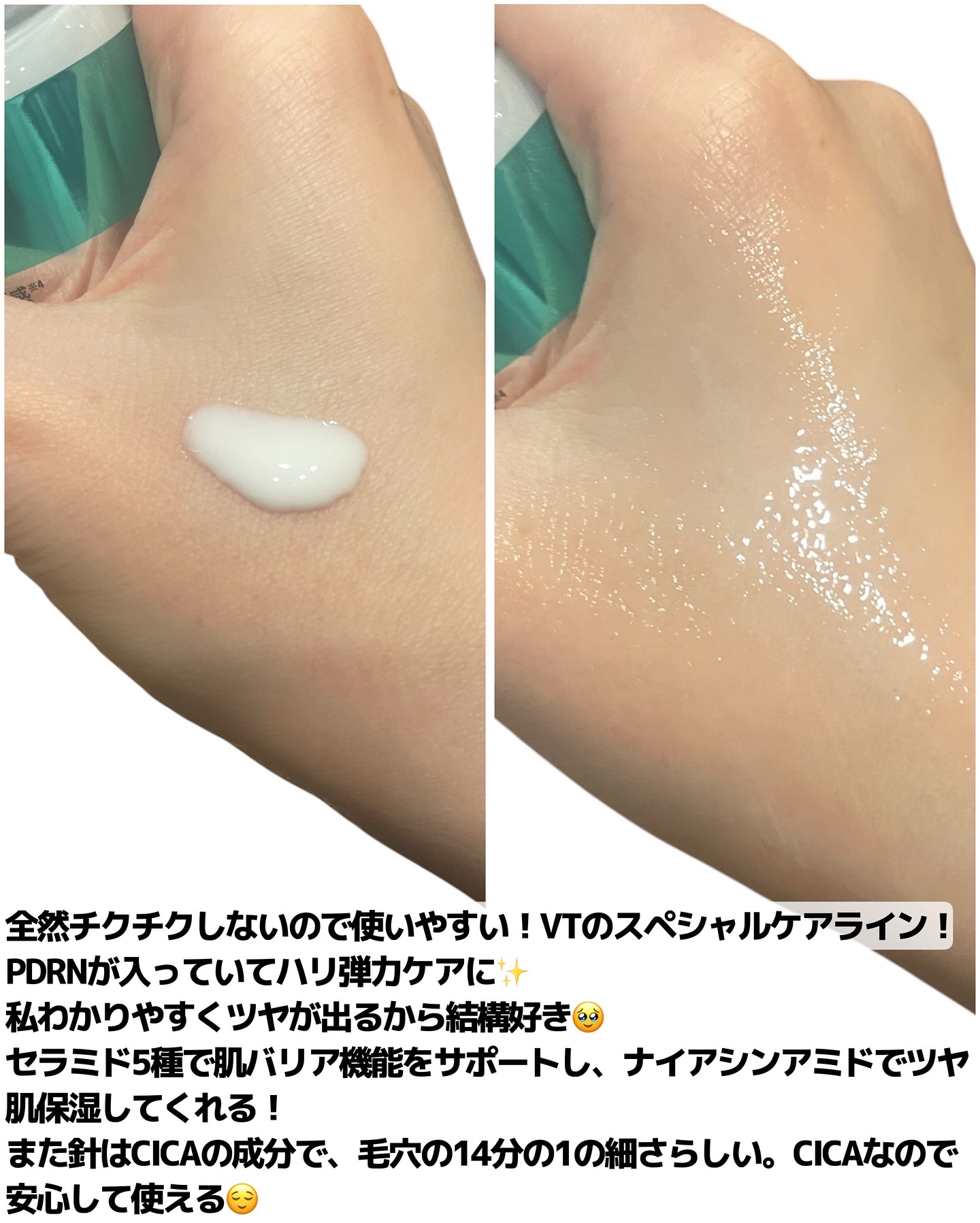リードルS PDRN+ セラム/VT/美容液を使ったクチコミ（2枚目）