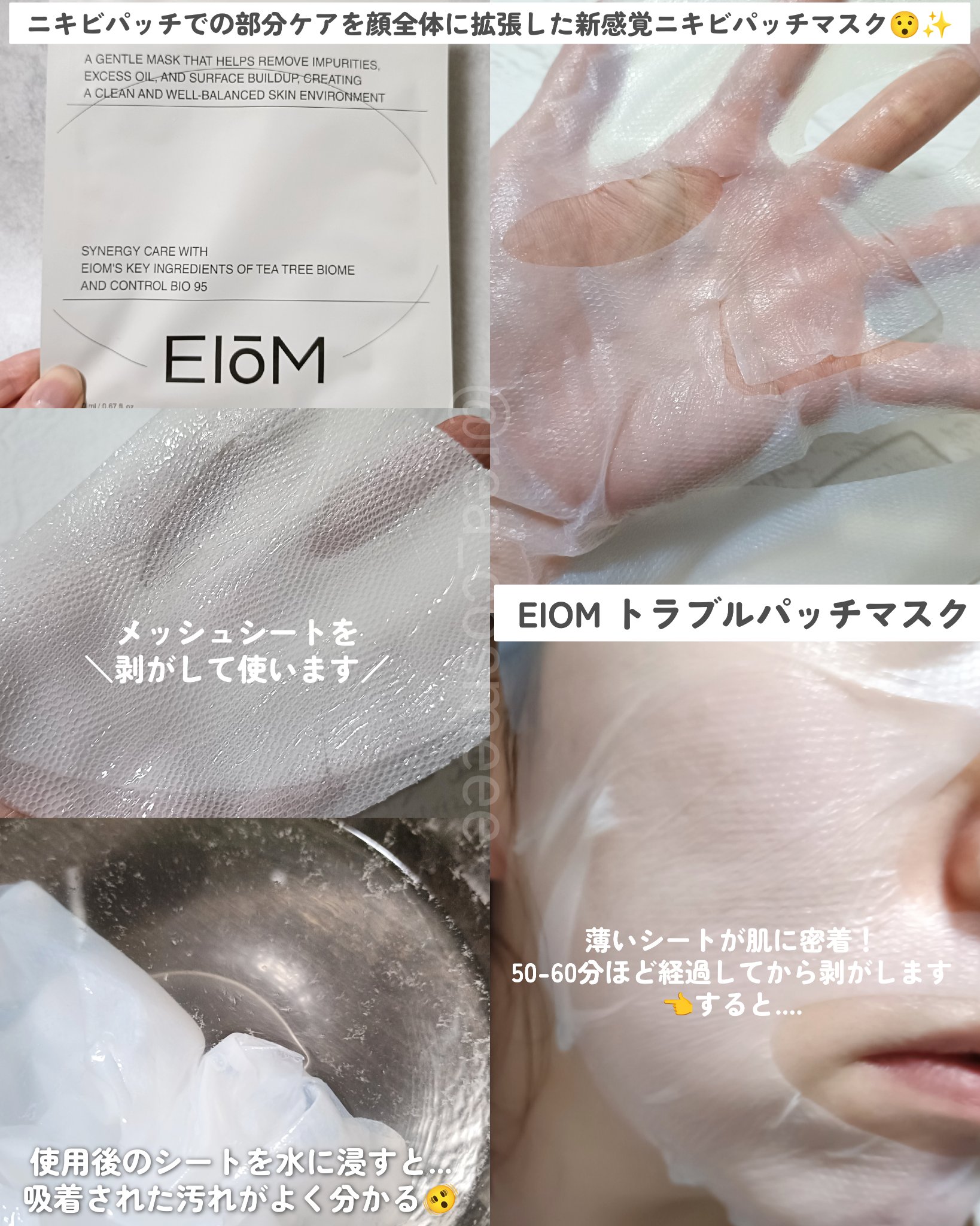 トラブルターゲティングセラム/EIOM/美容液を使ったクチコミ（2枚目）
