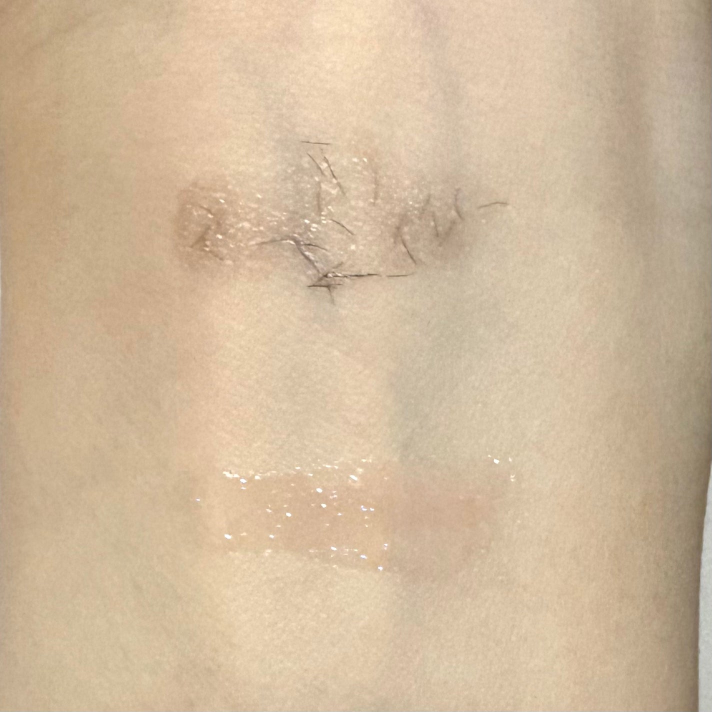 ちゅるリップランパー/muice/リッププランパーを使ったクチコミ(2枚目)