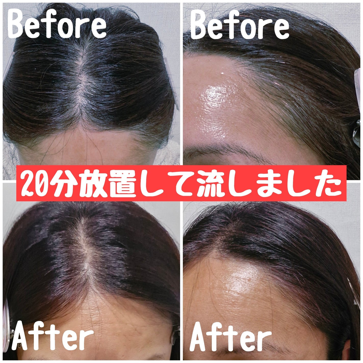 カラートリートメント/サイオス/ヘアカラーを使ったクチコミ(3枚目)