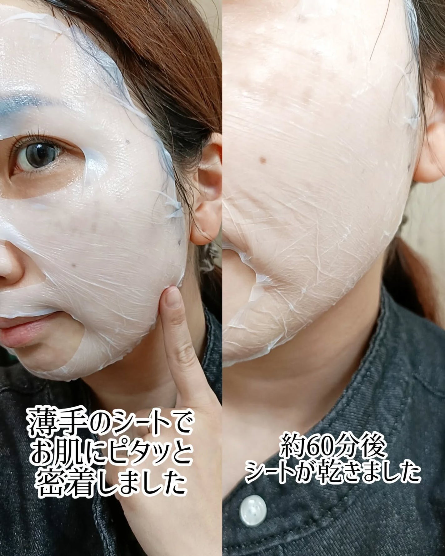 トラブルパッチマスク/EIOM/その他スキンケアを使ったクチコミ(4枚目)