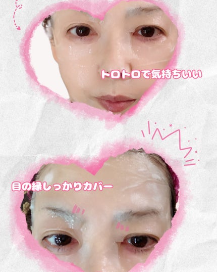 ロジーブルーム ビタミンブライトニングマスク/ATTATION/シートマスク・パックを使ったクチコミ(3枚目)