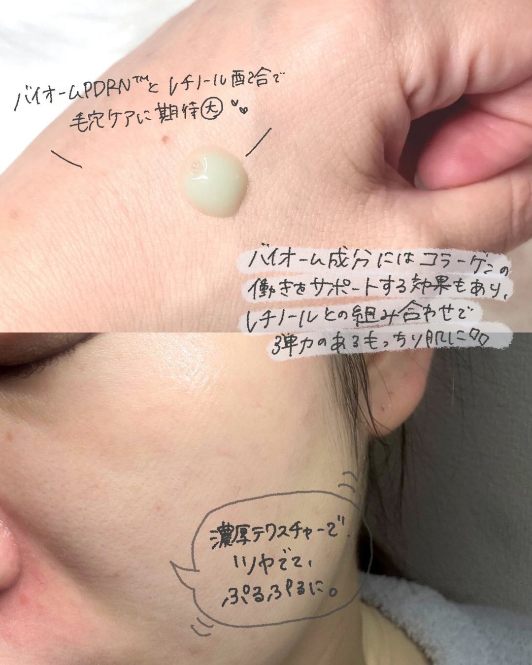 ReDRNエクソソームアンプル/Dr.nineteen/美容液を使ったクチコミ(3枚目)