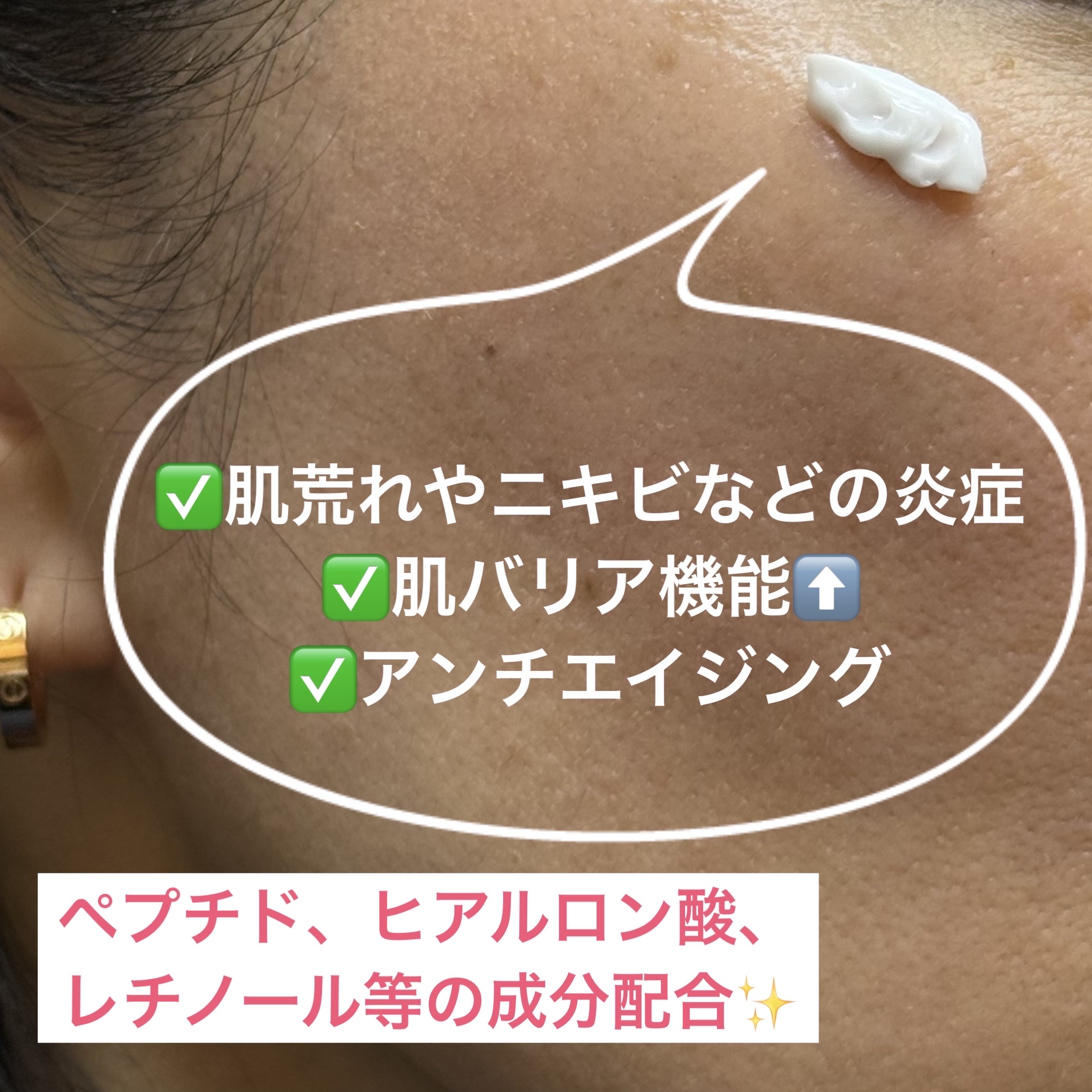 LASER REJUVENATION CREAM/Cell Fusion C(セルフュージョンシー)/フェイスクリームを使ったクチコミ（2枚目）