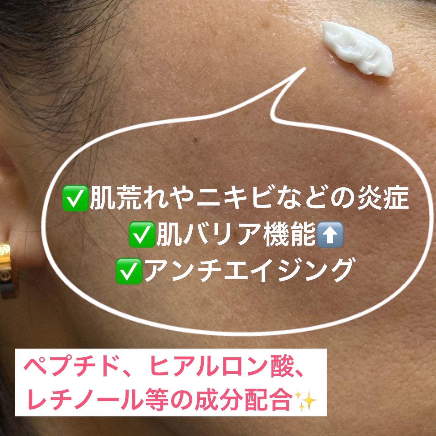 LASER REJUVENATION CREAM/Cell Fusion C(セルフュージョンシー)/フェイスクリームを使ったクチコミ(2枚目)