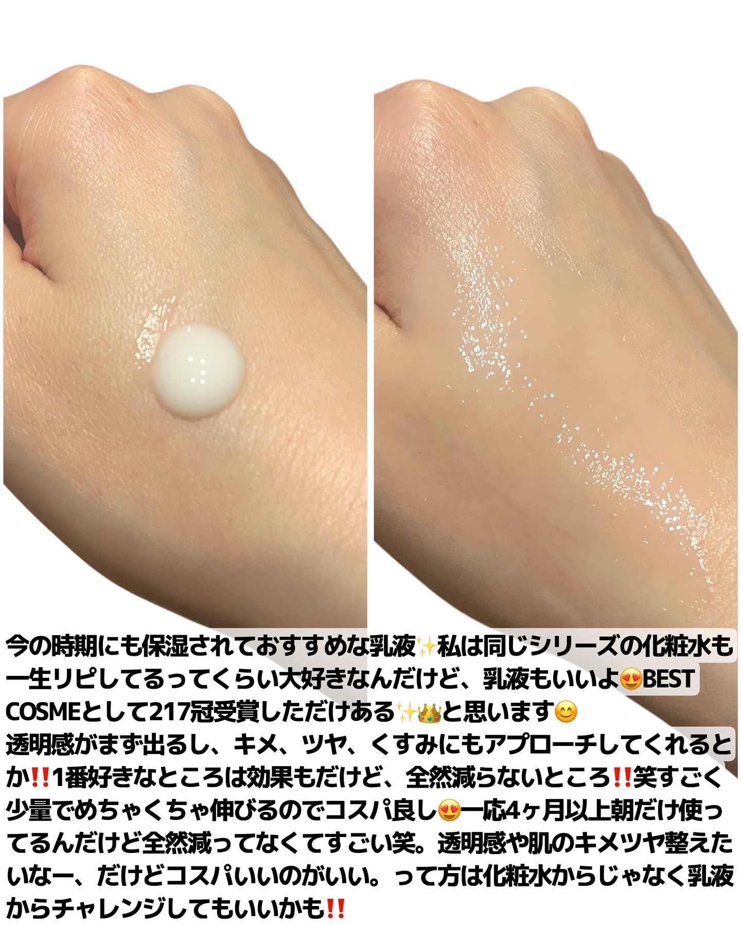 VC100エマルジョンEX/ドクターシーラボⓇ/乳液を使ったクチコミ（3枚目）