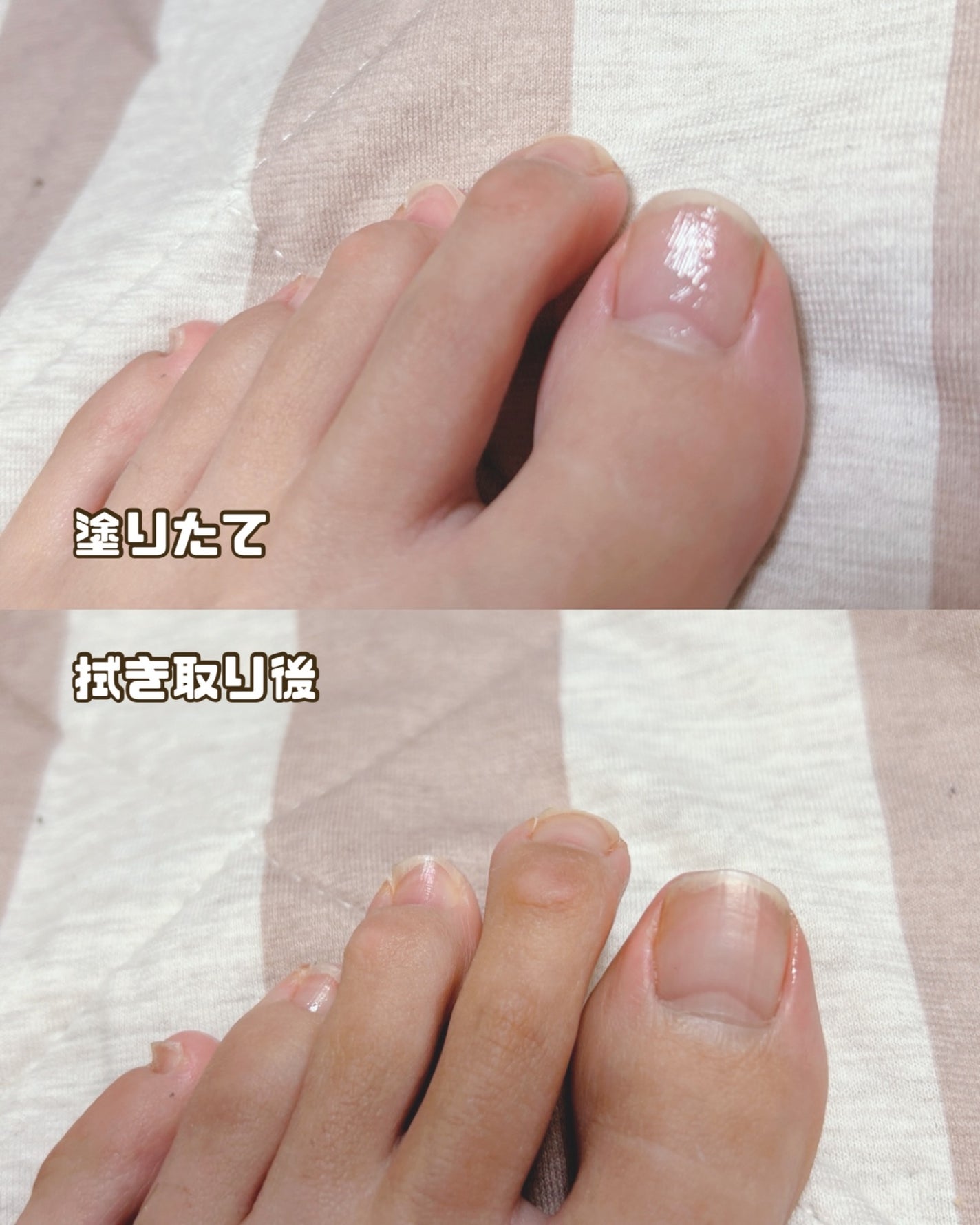 ãããðãã©ãã on LIPS ããããŒãããè¶³çªãããã£ã³ããã¯â¡@babyfoot_jp_也..ãïŒ3æç®ïŒ