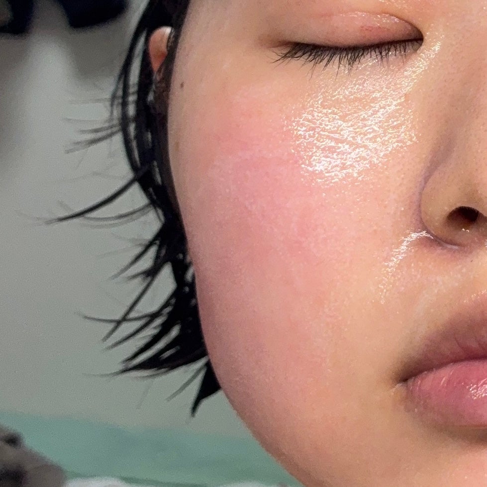 リードルS PDRN+ セラム/VT/美容液を使ったクチコミ(3枚目)