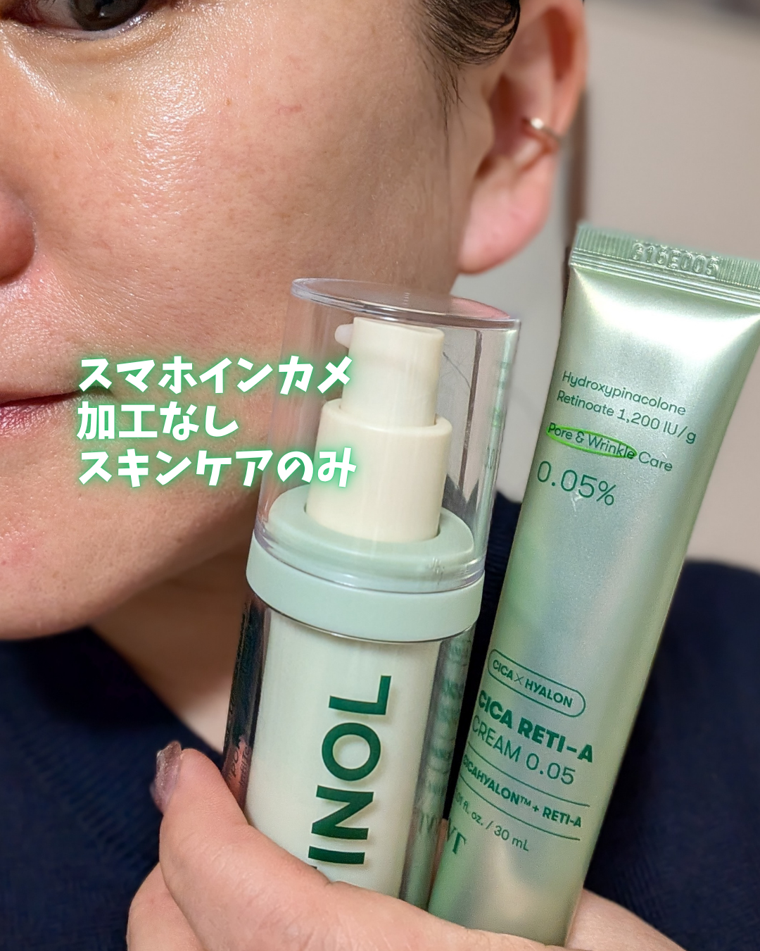 シカレチA クリーム0.05/VT/フェイスクリームを使ったクチコミ（3枚目）