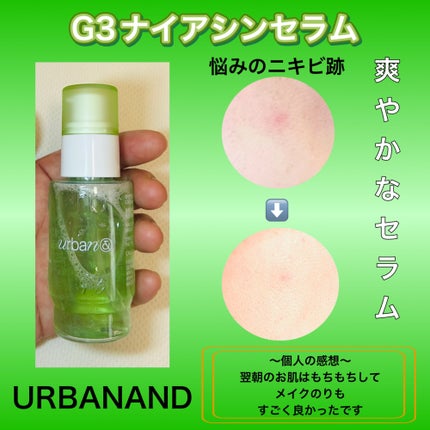 G3ナイアシンセラム/urbanand/美容液を使ったクチコミ(3枚目)