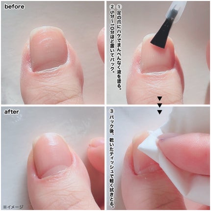 ベビーフット 足爪プロティンパック/ベビーフット/レッグ・フットケアを使ったクチコミ(4枚目)