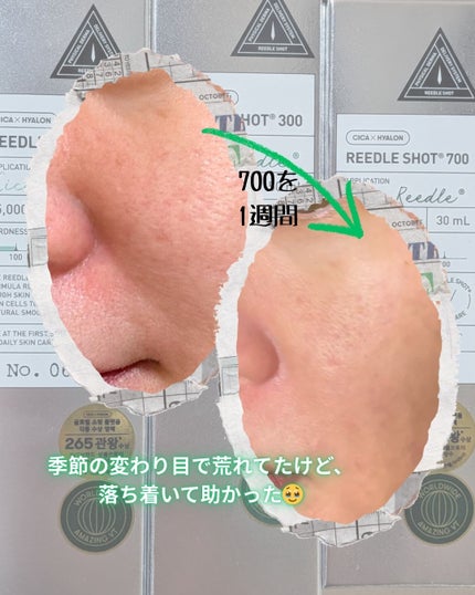 リードルショット300/VT/美容液を使ったクチコミ(3枚目)