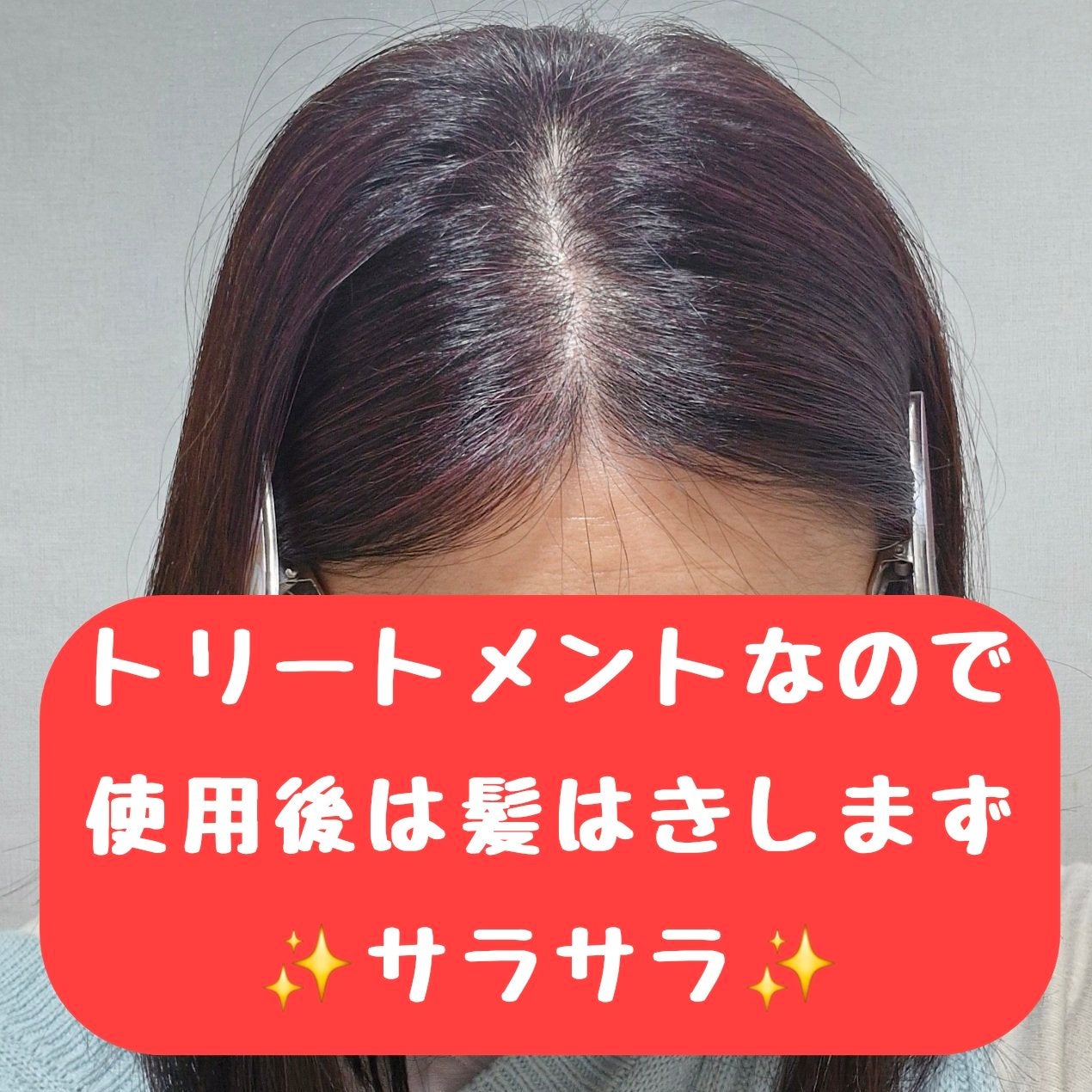 カラートリートメント/サイオス/ヘアカラーを使ったクチコミ(4枚目)