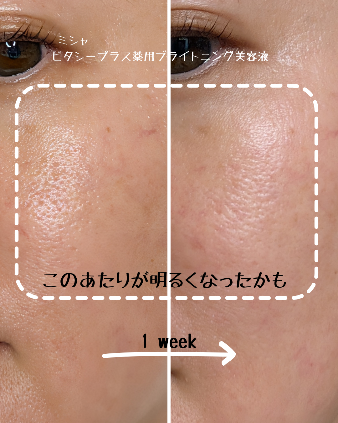 ミシャ ビタシープラス 薬用ブライトニング美容液/MISSHA/美容液を使ったクチコミ（2枚目）