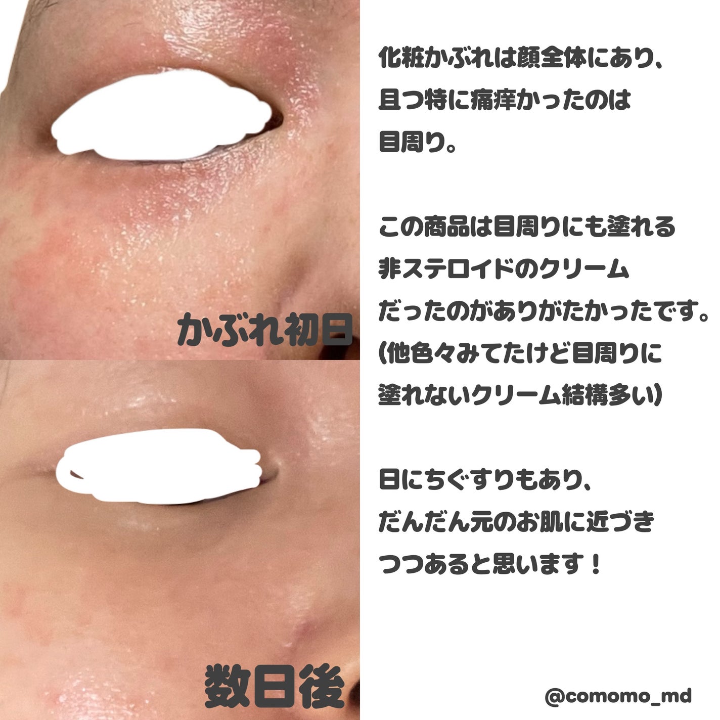 キュアレア(医薬品)/キュアレアa/その他を使ったクチコミ(3枚目)