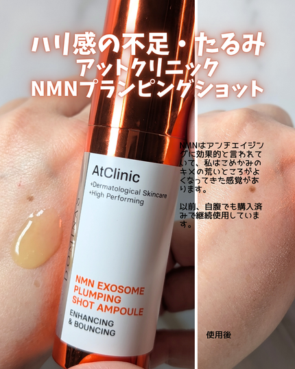 アットクリニックリンクルショットアンプル/DOMINAS/美容液を使ったクチコミ(5枚目)