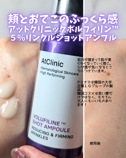 アットクリニックリンクルショットアンプル/DOMINAS/美容液を使ったクチコミ(4枚目)