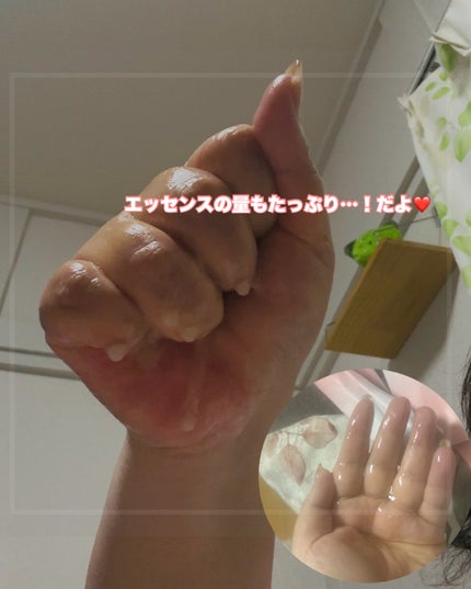 ROSY BLOOM VITAMIN BRIGHTENING SHEET MASK/ATTATION/シートマスク・パックを使ったクチコミ(3枚目)