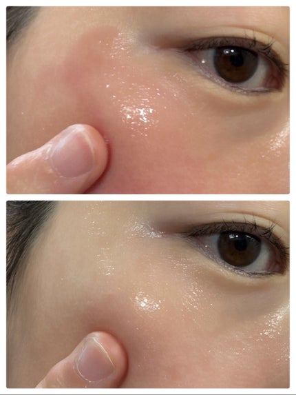 PDRNアルティメットオーラターゲットセラム/SAM'U/美容液を使ったクチコミ(4枚目)