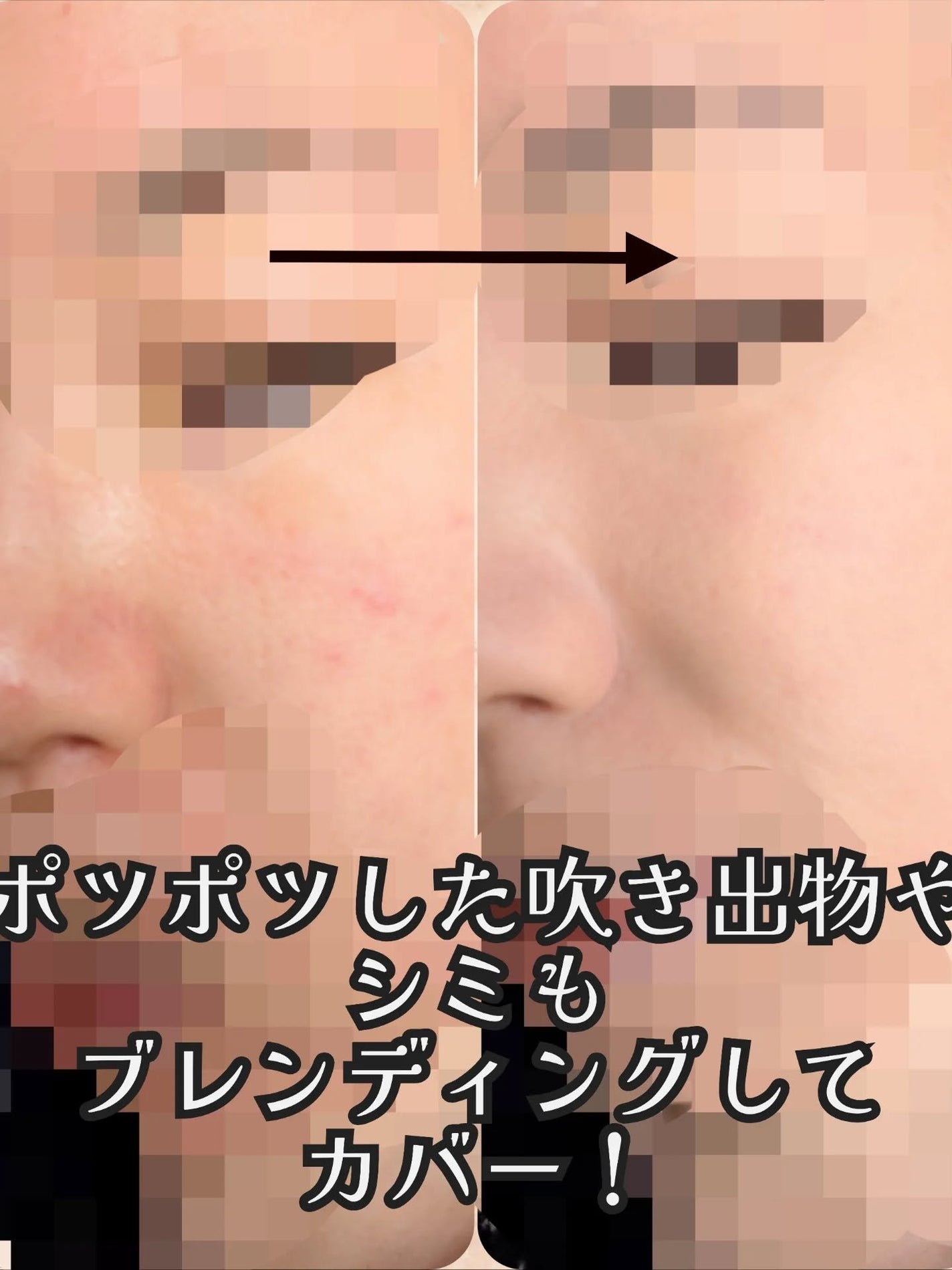 カバーアッププロコンシーラー/TFIT/パレットコンシーラーを使ったクチコミ(5枚目)