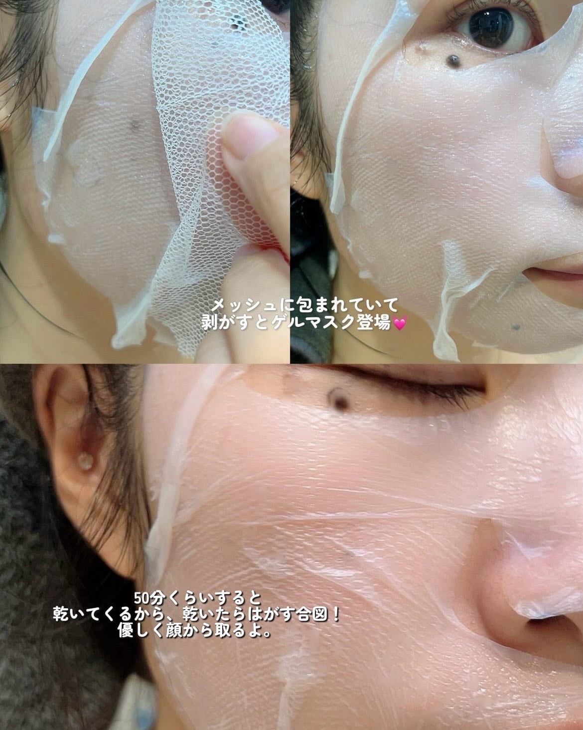 トラブルパッチマスク/EIOM/その他スキンケアを使ったクチコミ(3枚目)