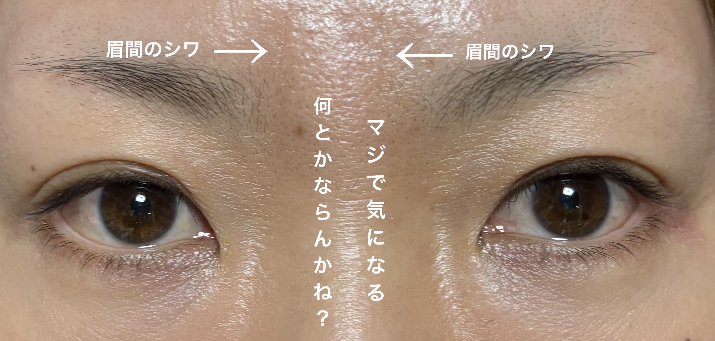 試してみた】リサージ リサージ ボーテ プレメインテナイザーの効果