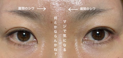 レチノパワー リンクルクリーム 15g(S)/エリクシール/アイケア・アイクリームの画像