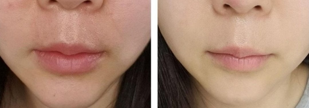 Apomederm アポメダーム on LIPS 「1週間の利用レビュー✨最近肌の悩みが多いので、この美しい宝物ク..」(2枚目)