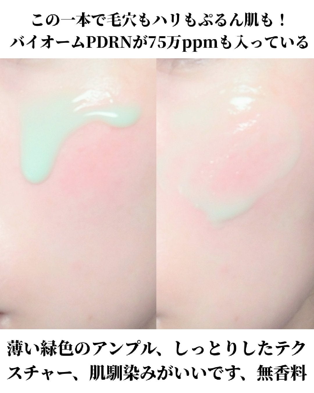 ReDRNエクソソームアンプル/Dr.nineteen/美容液を使ったクチコミ(2枚目)