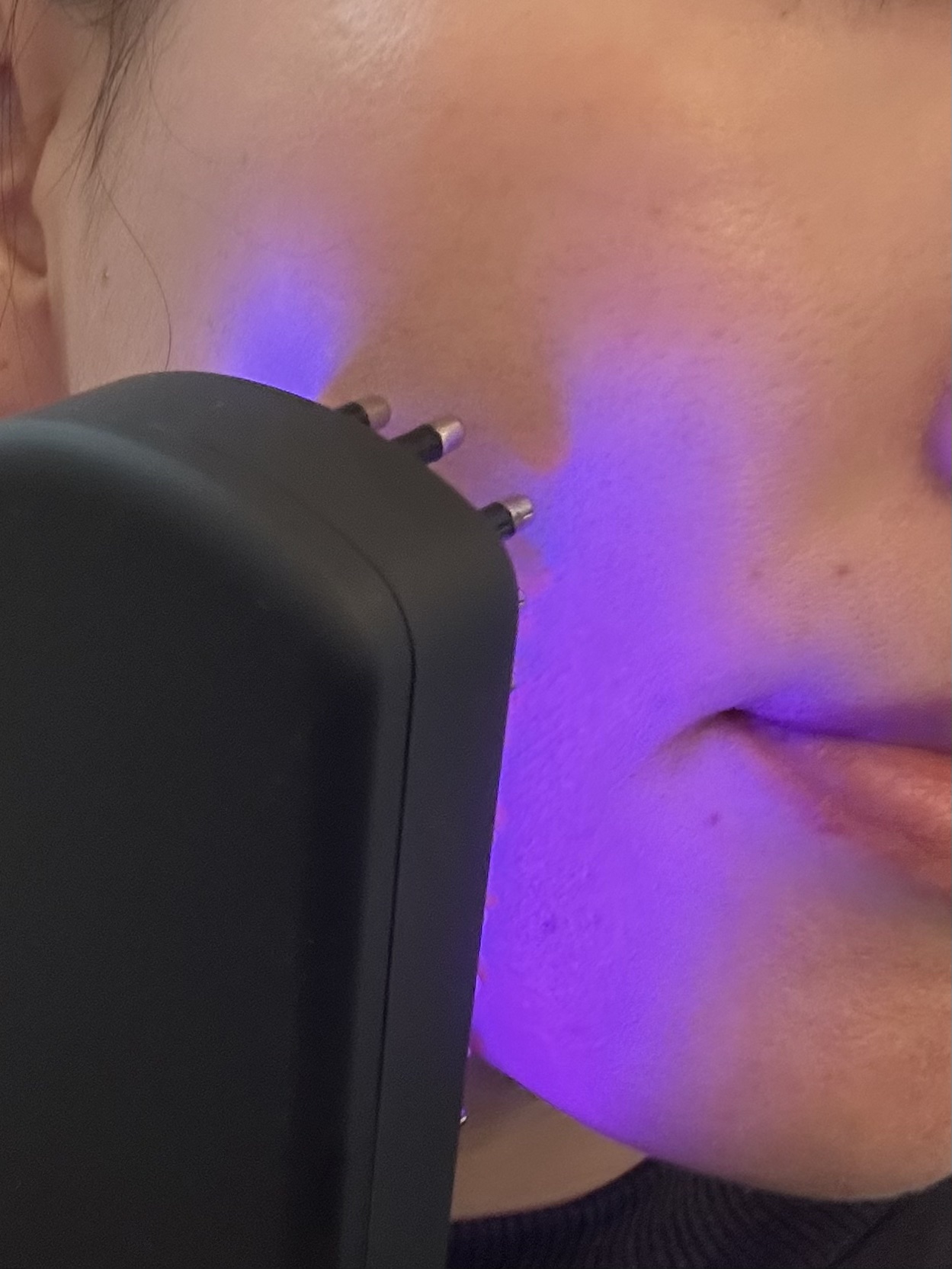 ELEKI BRUSH＋/Brighte/美顔器・マッサージを使ったクチコミ（3枚目）