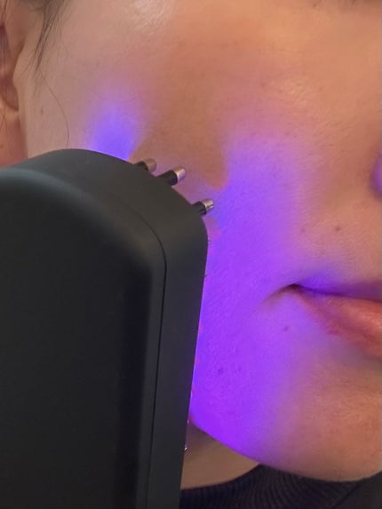 ELEKI BRUSH+/Brighte/美顔器・マッサージを使ったクチコミ(3枚目)