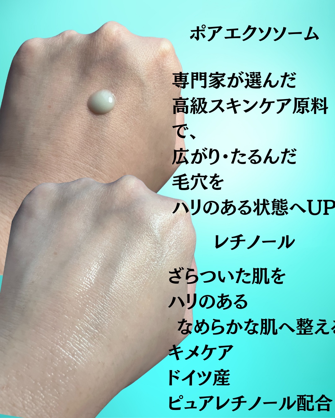 ReDRNエクソソームアンプル/Dr.nineteen/美容液を使ったクチコミ（2枚目）