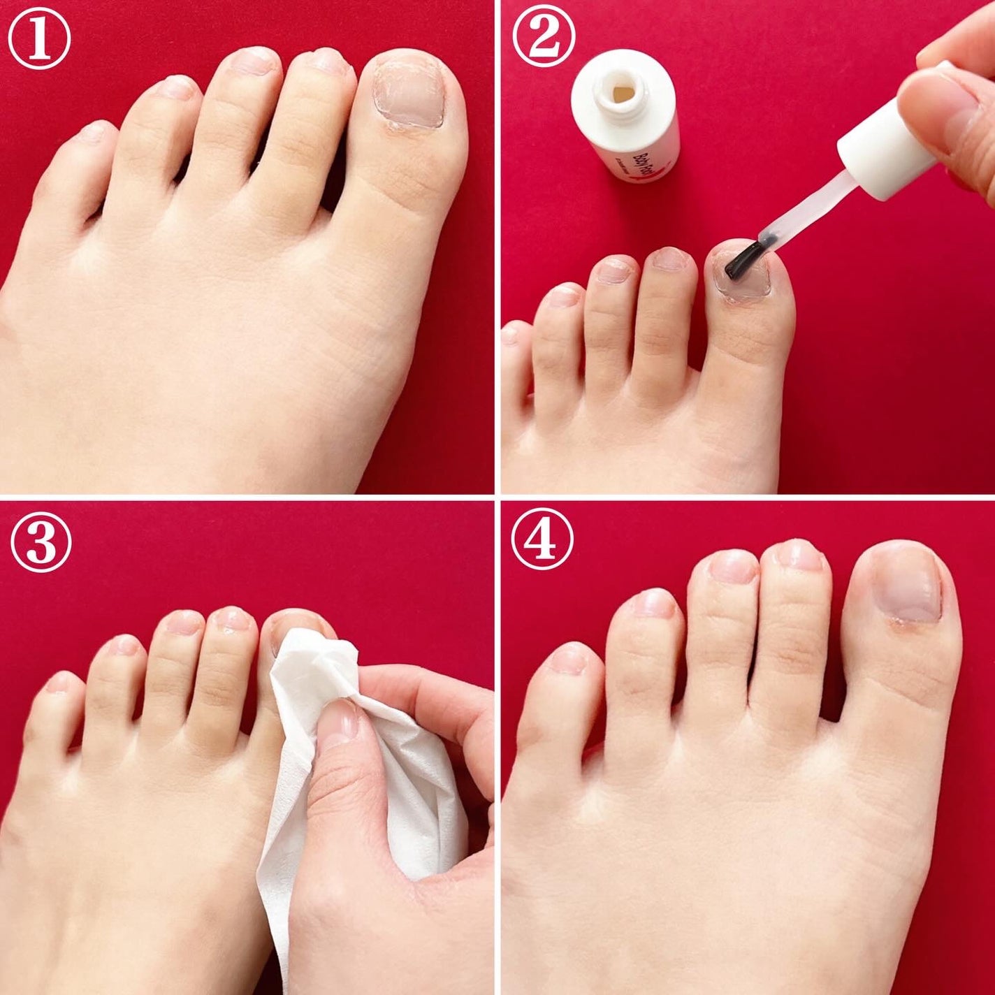 ベビーフット 足爪プロティンパック/ベビーフット/レッグ・フットケアを使ったクチコミ(5枚目)