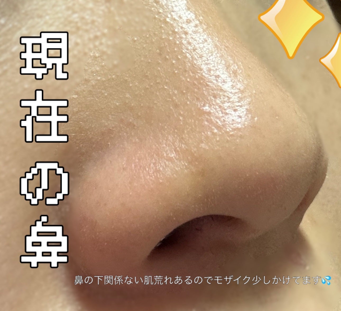 ディープクリア洗顔パウダー/ファンケル/洗顔パウダーを使ったクチコミ(3枚目)