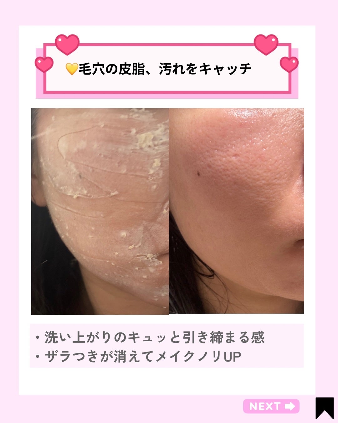 ユルムスキンクリーンパック/RETURNITY/洗い流すパック・マスクを使ったクチコミ(5枚目)